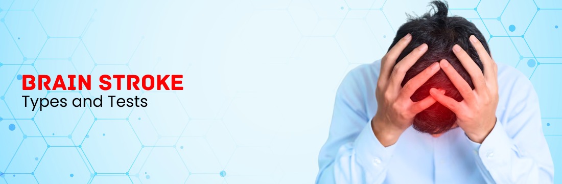 Brain Stroke: Types and Tests Required for Diagnosis